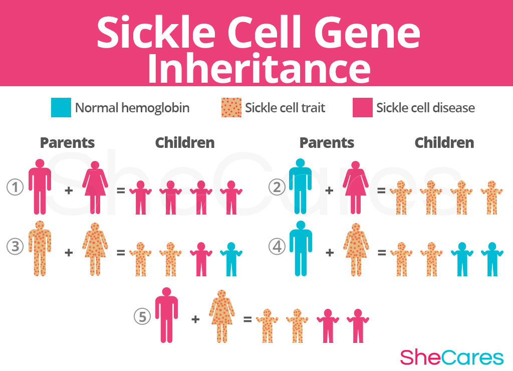 sickle-cell-gene-inheritan
